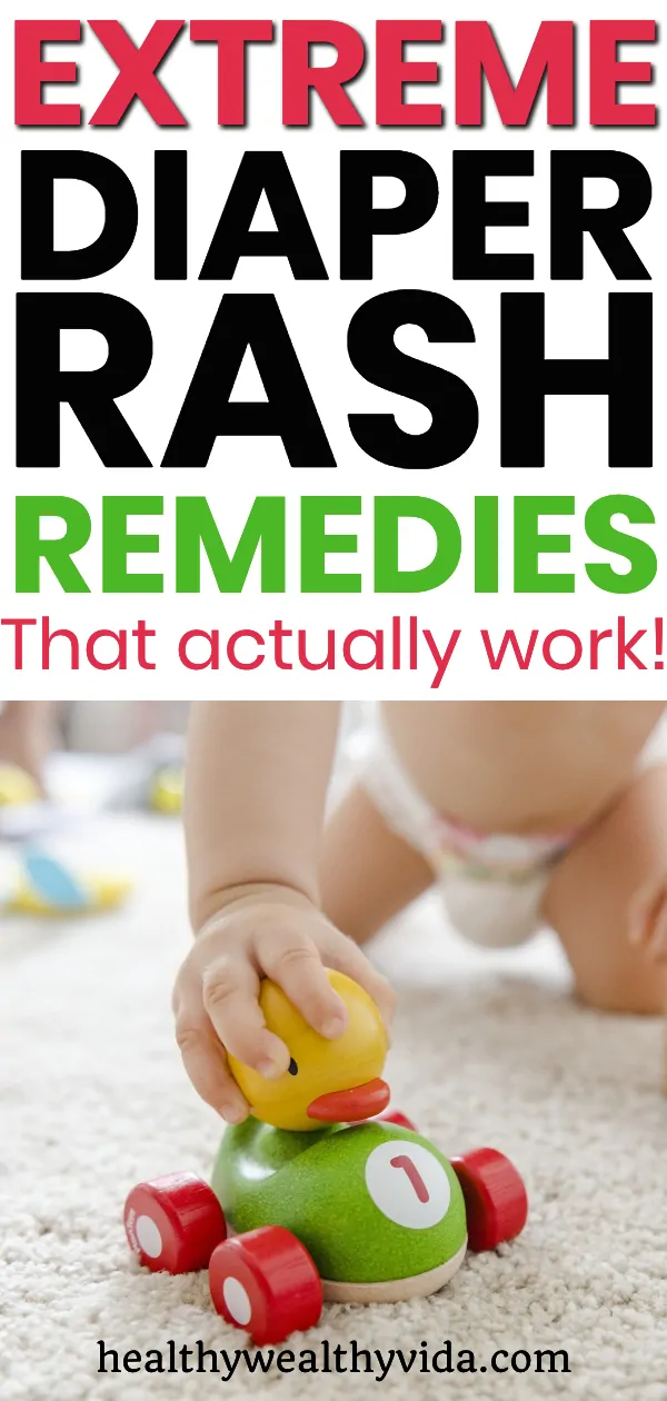 Extreme Diaper Rash Remedies That Actually Work