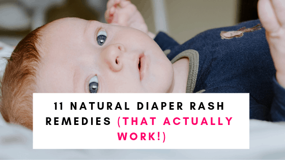 11 Natural Diaper Rash Remedies that work