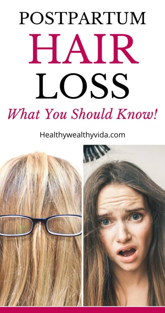 Postpartum Hair Loss And The Things You Should Know!